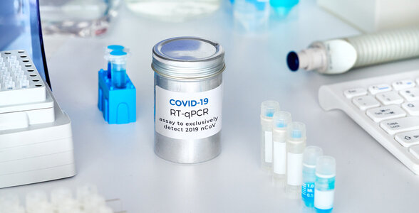 Negative RT-PCR test